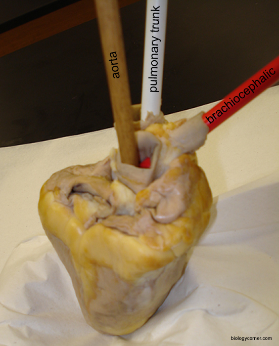 brachiocephalic