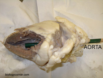 heart aorta