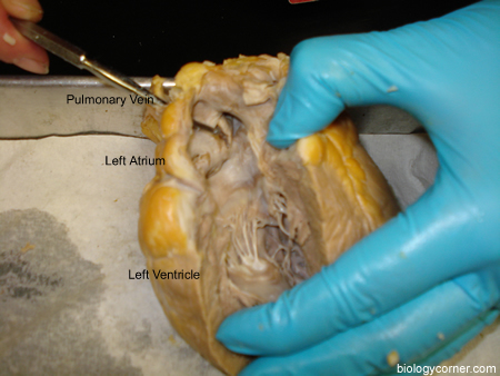heart ventricle