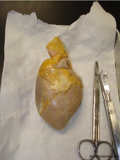 heart 1