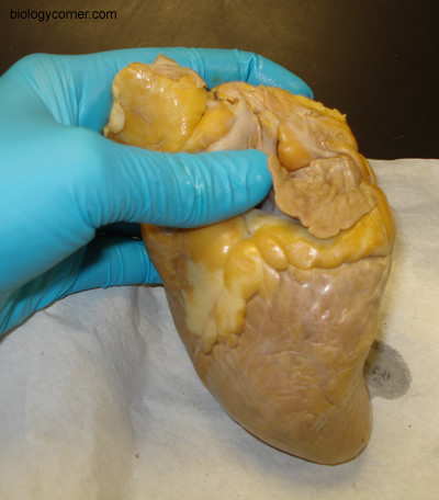 heart auricle