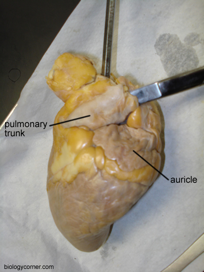 heart pulmonary