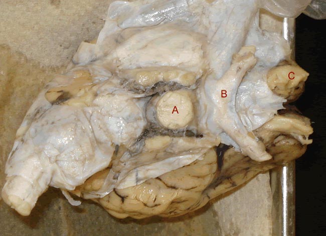 optic chiasma