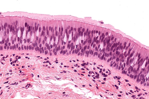 epithelial tissue