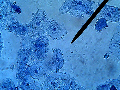 observe cheek cells under the microscope