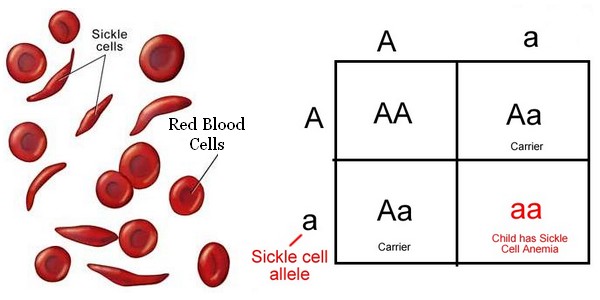 Is Sickle Cell Anemia A Sex Linked Trait 88