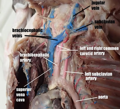 Anatomy & Physiology