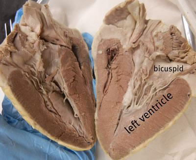 Basic A&P Labelling Human Heart Quiz