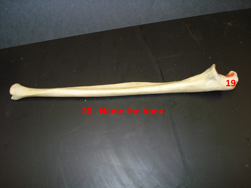 leg bone