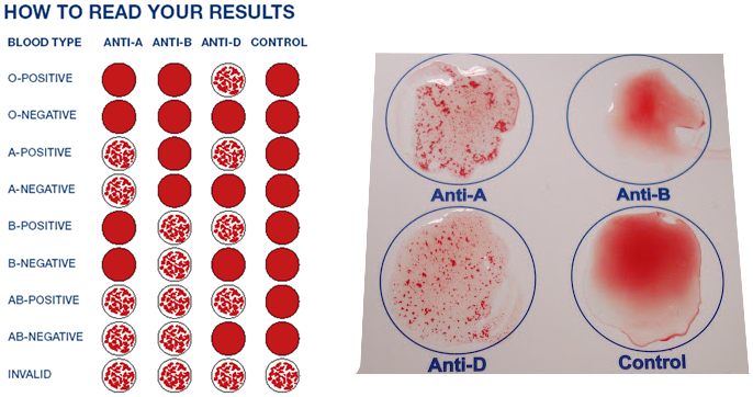 Antigen Antibody Blood Type Chart