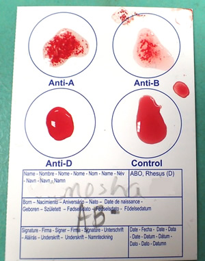 Eldoncard Blood Typing Kit, 3 Tests, Know Your Blood
