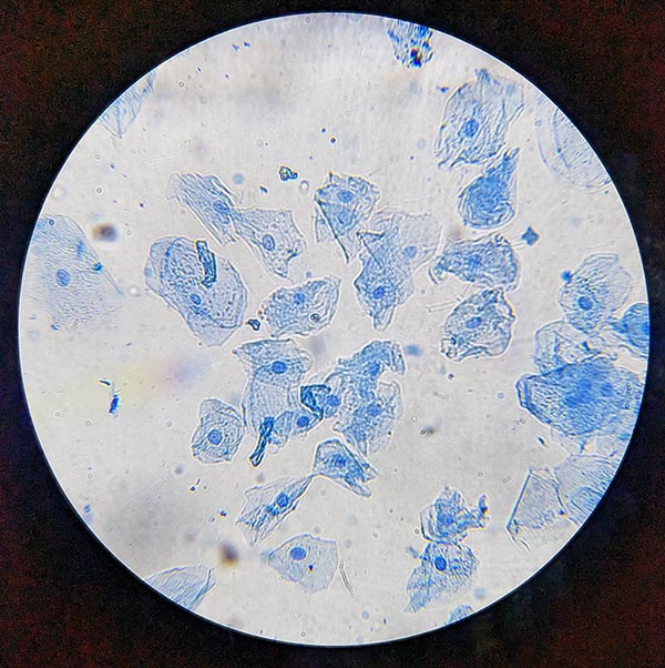 Cheek Cell Under Microscope Cheek Cell Under Microscope