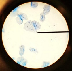 cheek cells