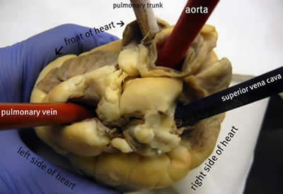 labeled heart