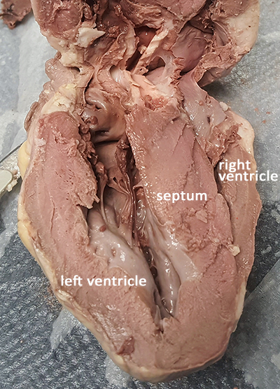 heart incision 1