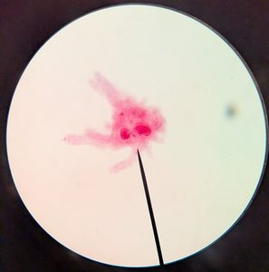 amoeba at 400x magnification