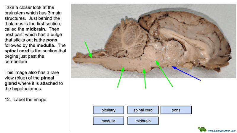 Brain Dissection – Virtual Version