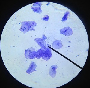 cheek cells
