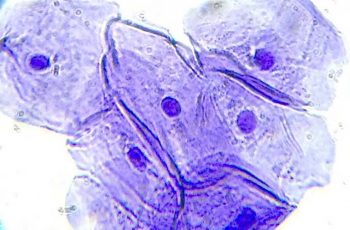 How to View Cheek Cells with a Microscope