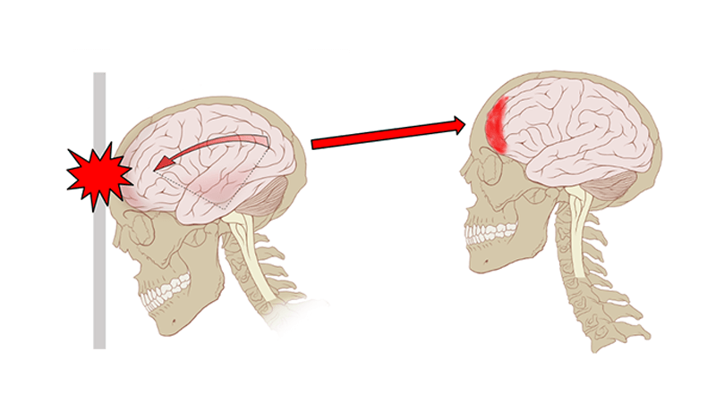 brain case studies assignment answer key