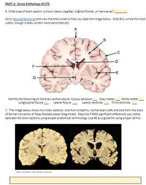 brain case studies assignment answer key