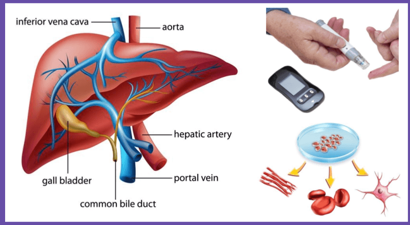 Stem Cell Therapy for Type 1 Diabetes