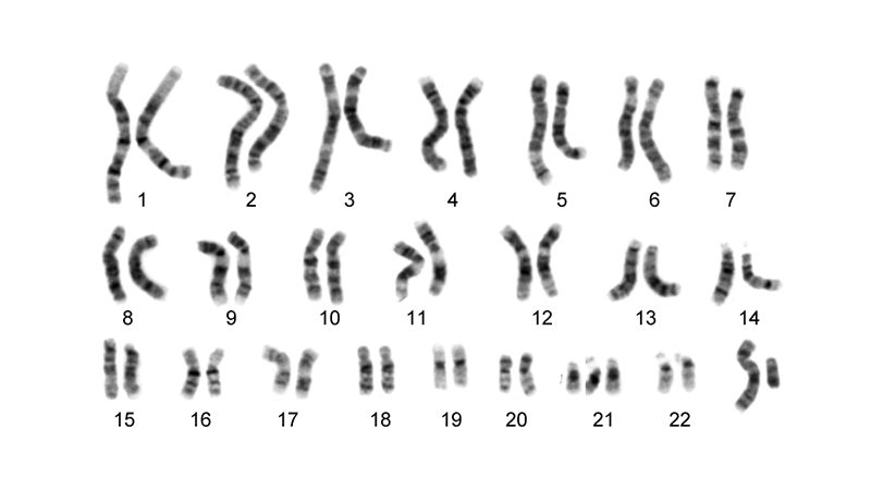 How Are Karyotypes Used to Diagnose Genetic Disorders?
