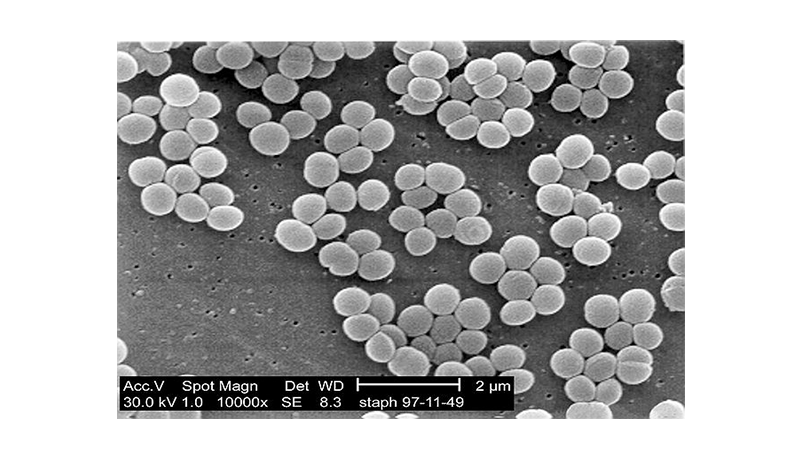 Case Study – Are Nanobacteria Alive?